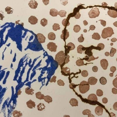 Natural Immunity elastoplast © Sheena Vallely