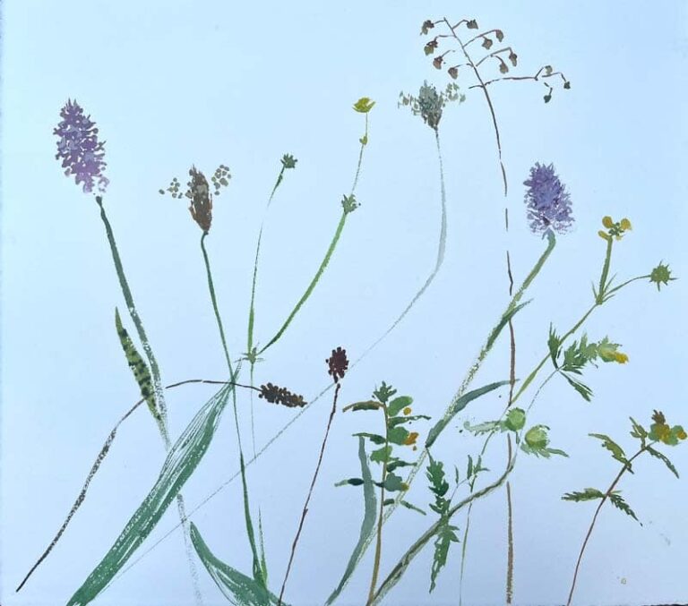 Up on the Downs by Sheena Vallely